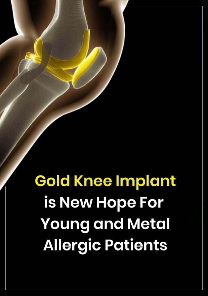 Golden knee implant