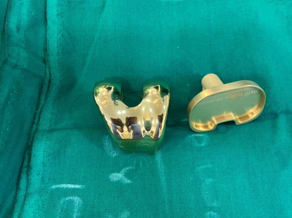 Gold Plated Knee Implant