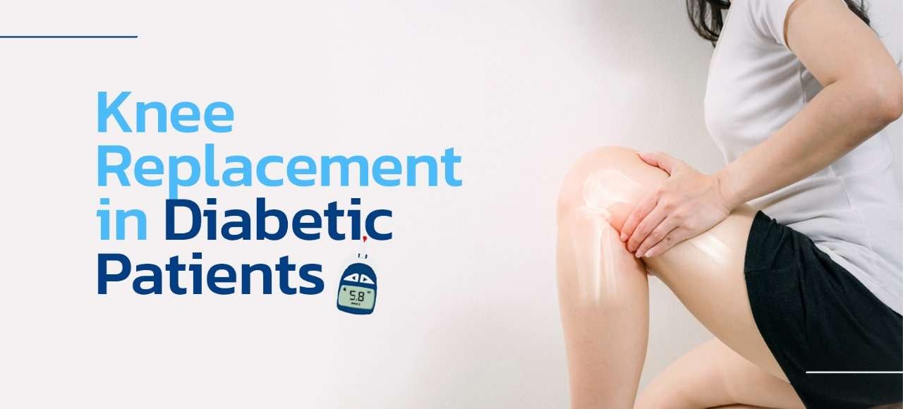 kNEE Repacemnt in diabetic patients