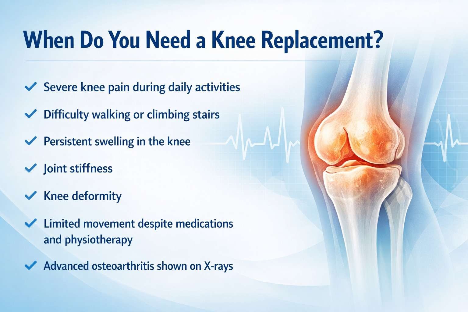 When Do You Need a Knee Replacement?
